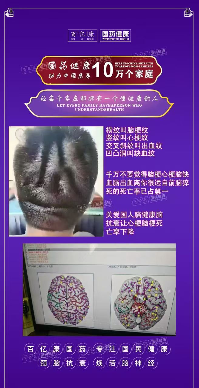 图片[13]-❤️❤️百亿康脑抗衰·体验前后效果真实案例！-百亿康