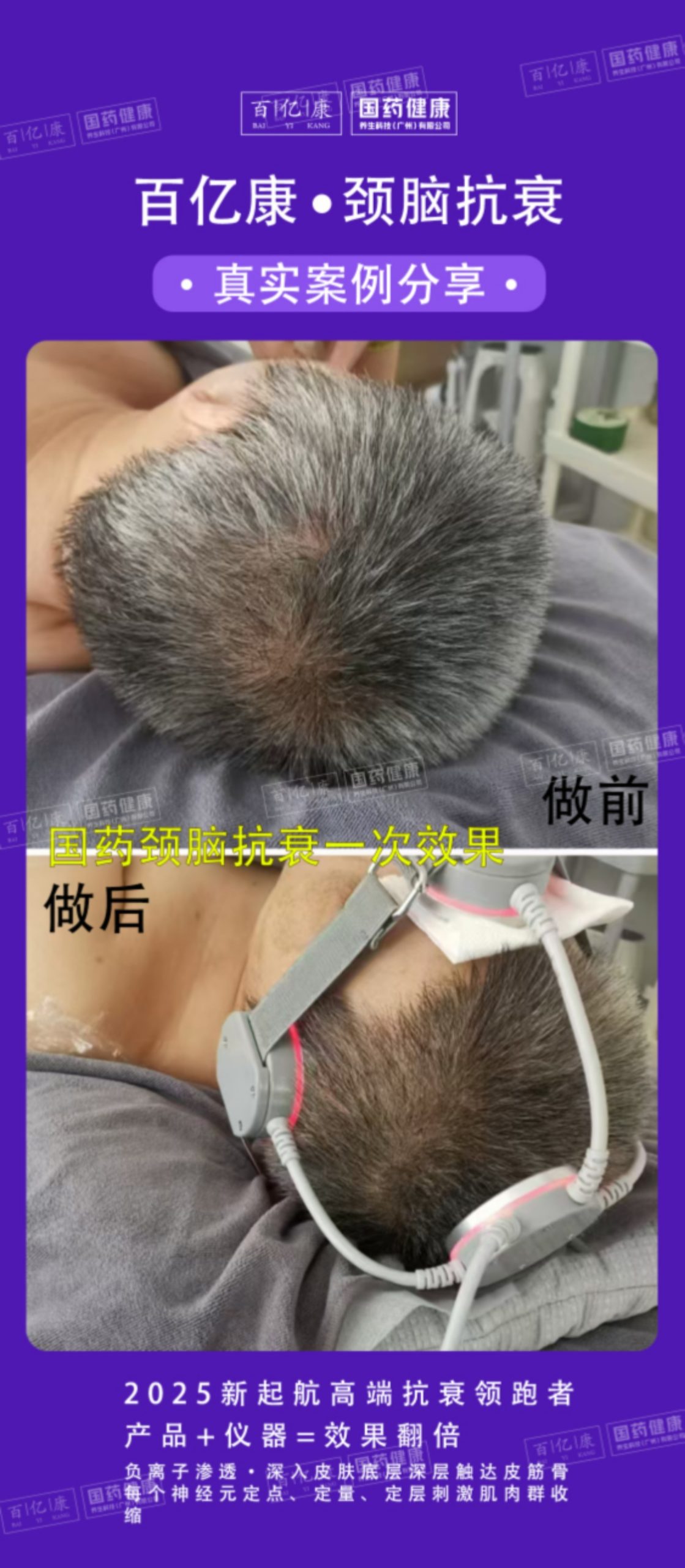 图片[11]-❤️❤️百亿康脑抗衰·体验前后效果真实案例！-百亿康