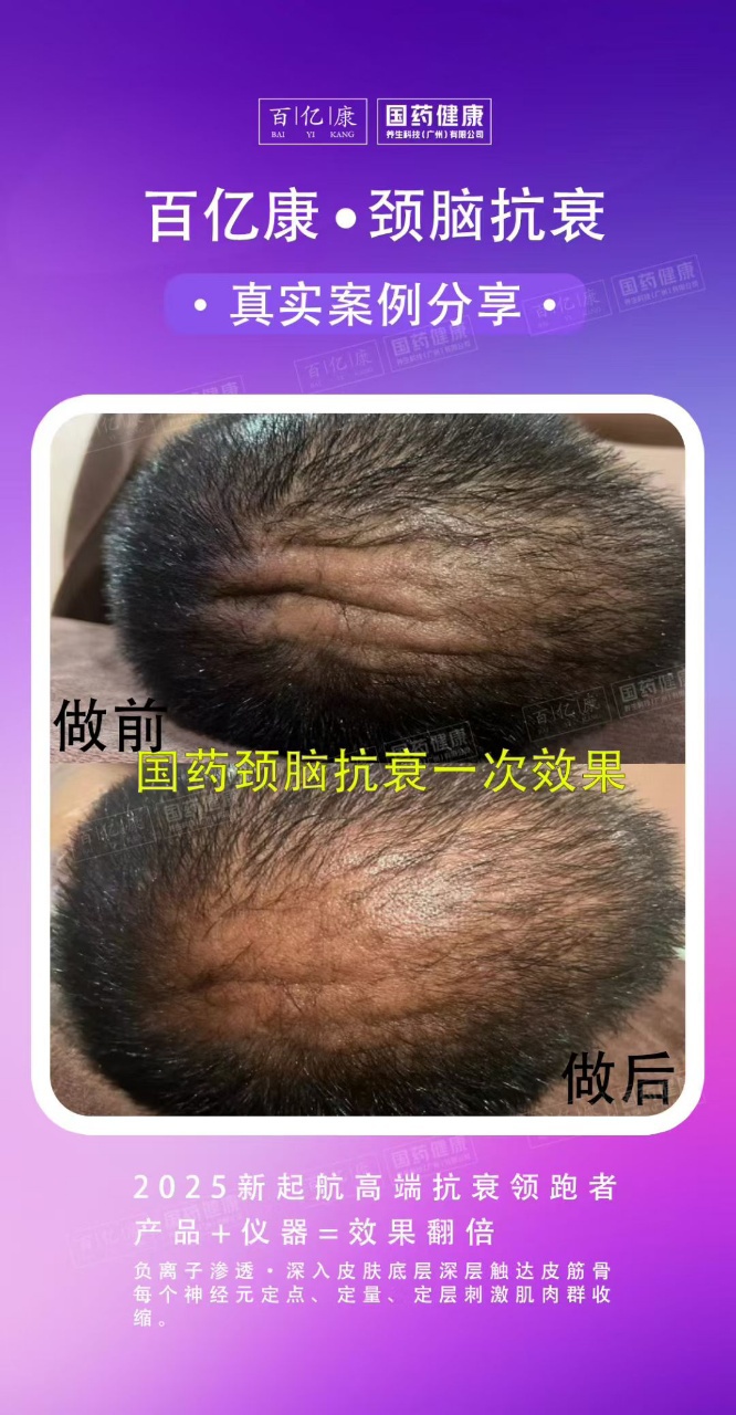 图片[14]-❤️❤️百亿康脑抗衰·体验前后效果真实案例！-百亿康