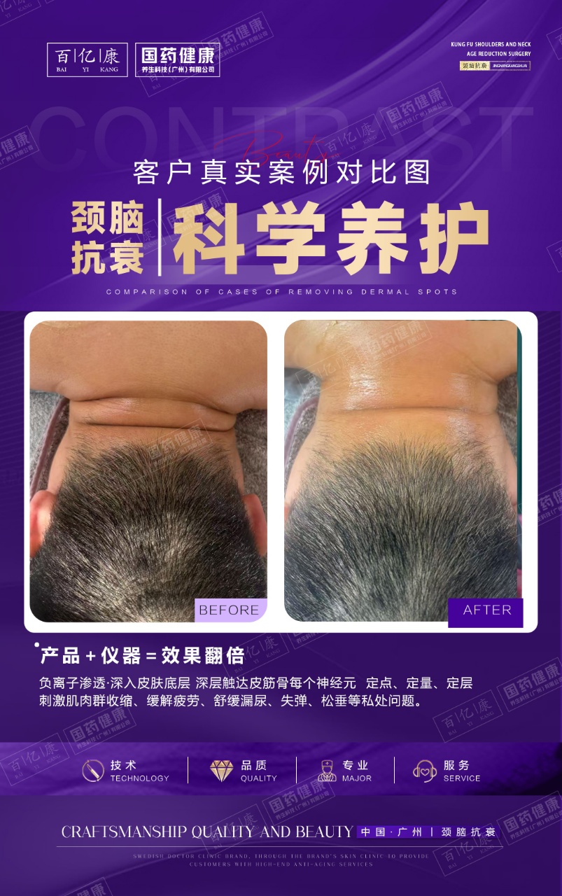 图片[19]-❤️❤️百亿康脑抗衰·体验前后效果真实案例！-百亿康
