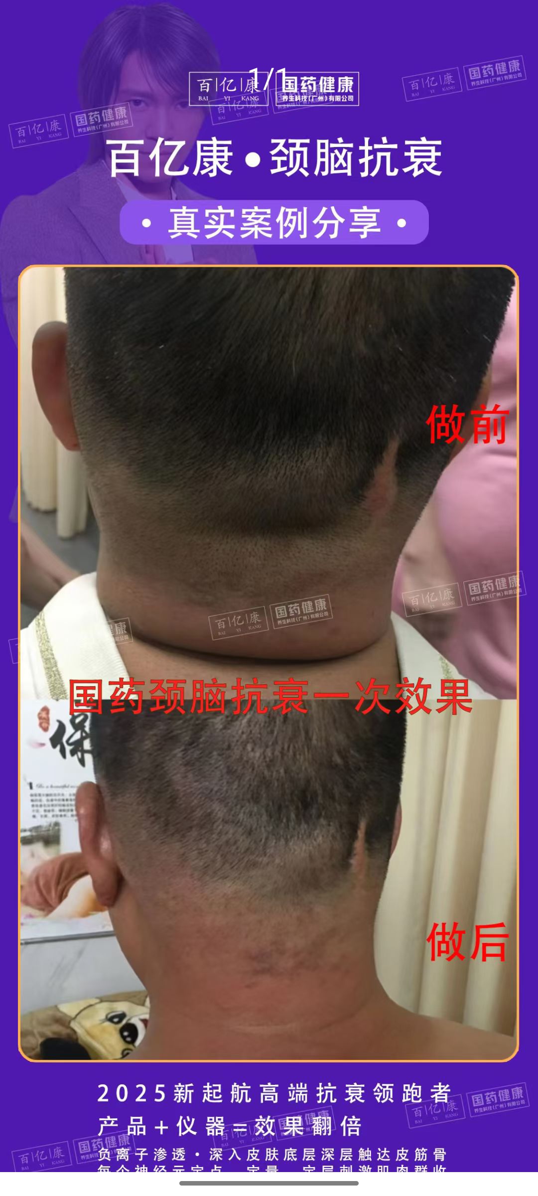 图片[22]-❤️❤️百亿康脑抗衰·体验前后效果真实案例！-百亿康