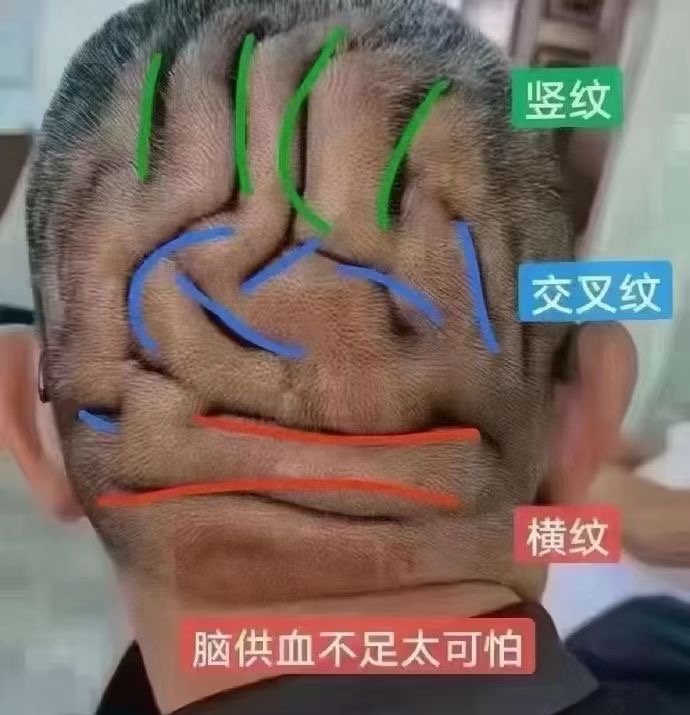 图片[18]-❤️❤️百亿康脑抗衰·体验前后效果真实案例！-百亿康