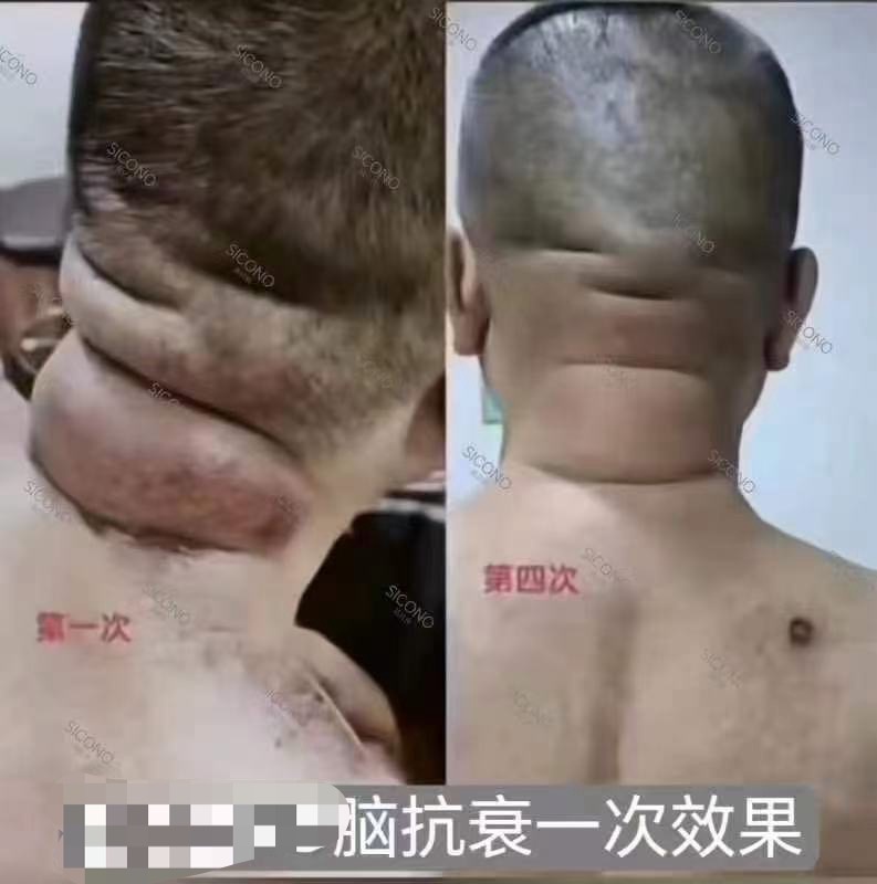 图片[20]-❤️❤️百亿康脑抗衰·体验前后效果真实案例！-百亿康