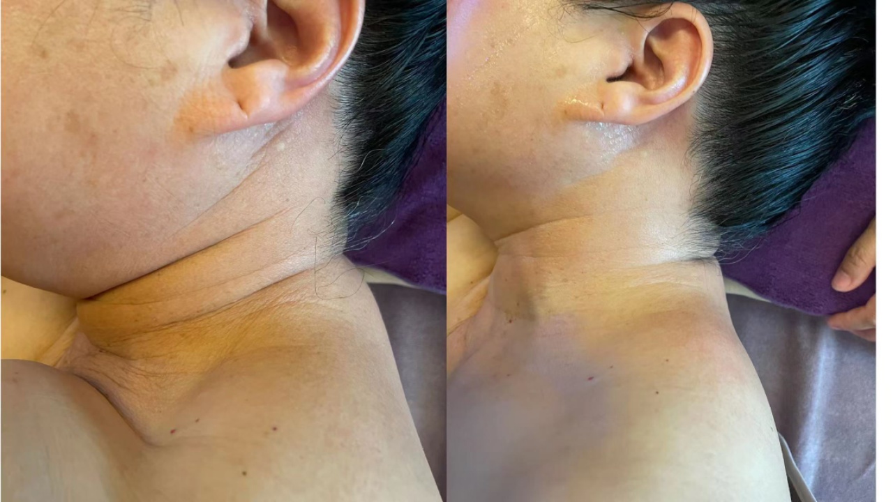 图片[26]-❤️❤️百亿康脑抗衰·体验前后效果真实案例！-百亿康