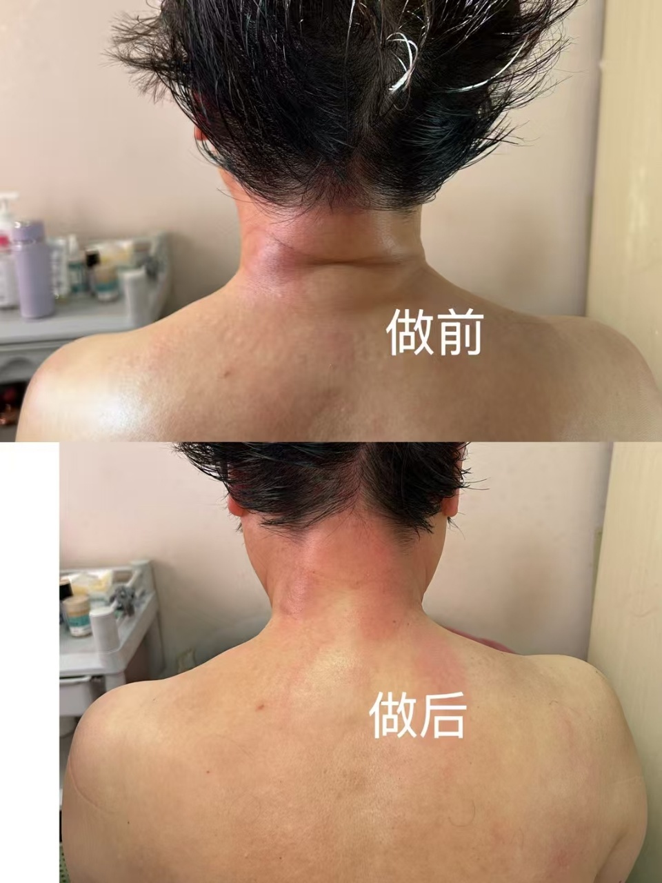 图片[21]-❤️❤️百亿康脑抗衰·体验前后效果真实案例！-百亿康