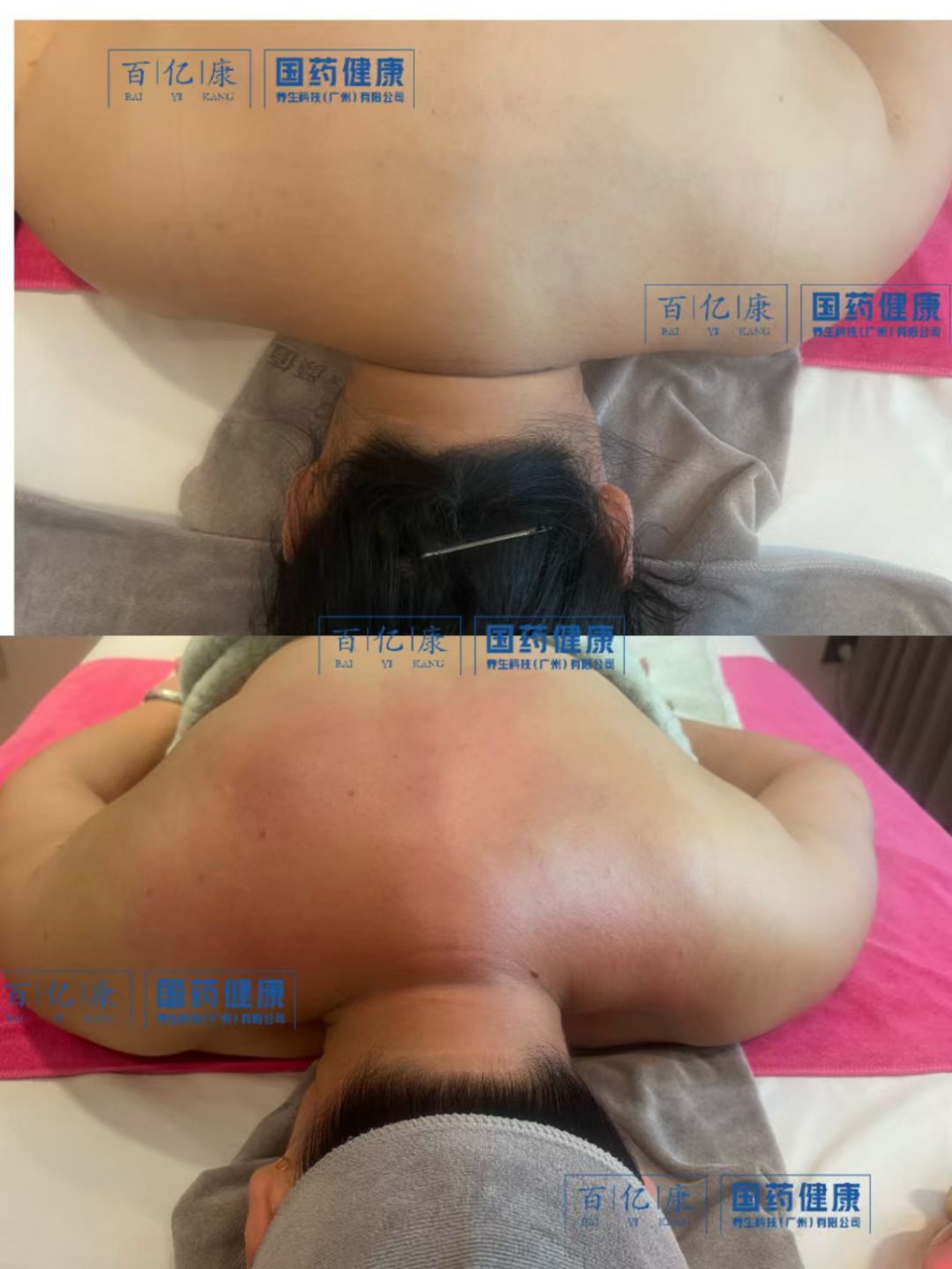 图片[29]-❤️❤️百亿康脑抗衰·体验前后效果真实案例！-百亿康