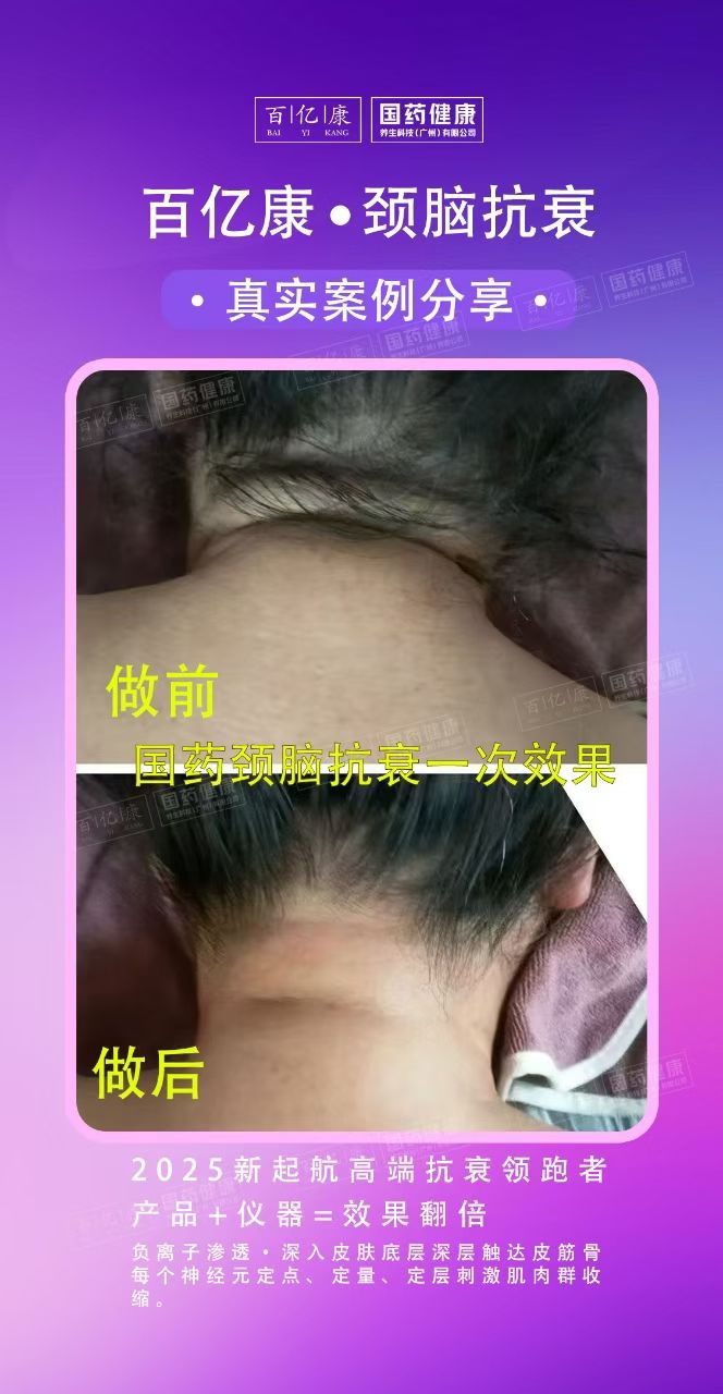 图片[28]-❤️❤️百亿康脑抗衰·体验前后效果真实案例！-百亿康