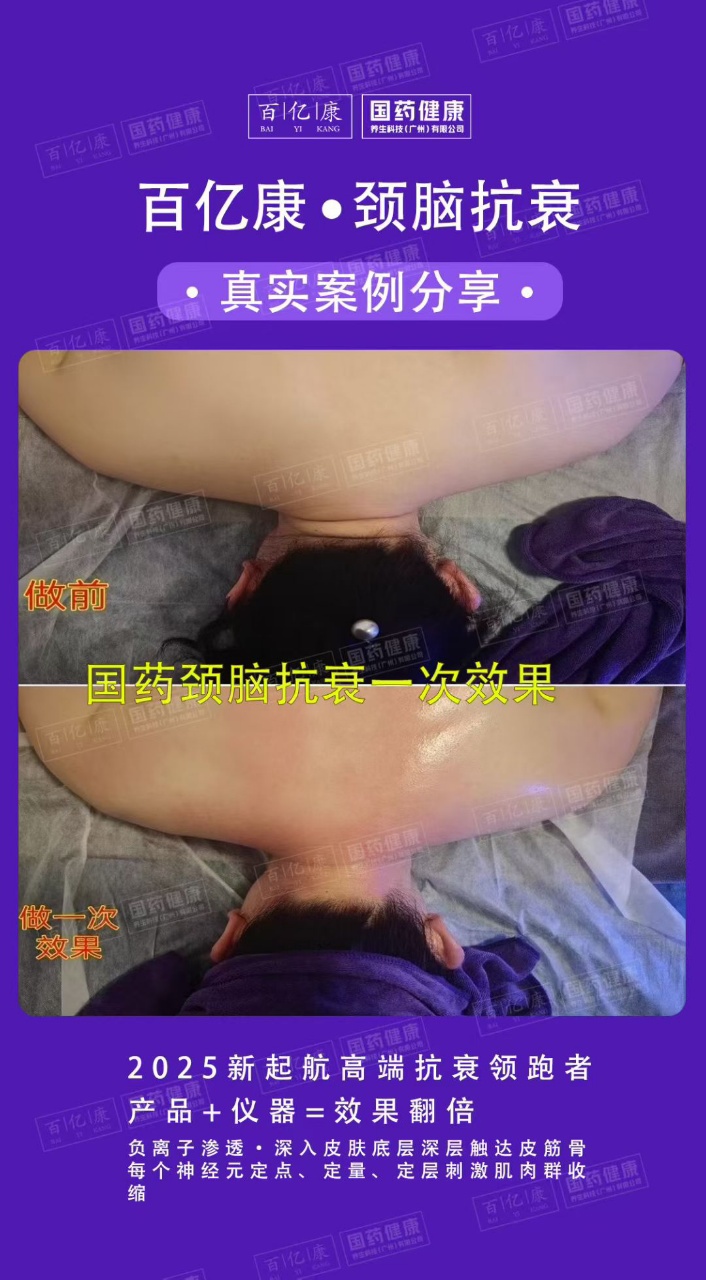 图片[30]-❤️❤️百亿康脑抗衰·体验前后效果真实案例！-百亿康