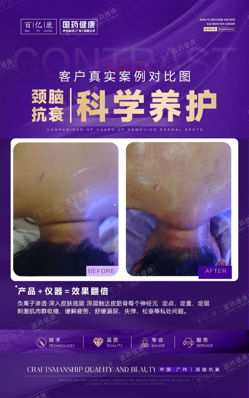 图片[36]-❤️❤️百亿康脑抗衰·体验前后效果真实案例！-百亿康