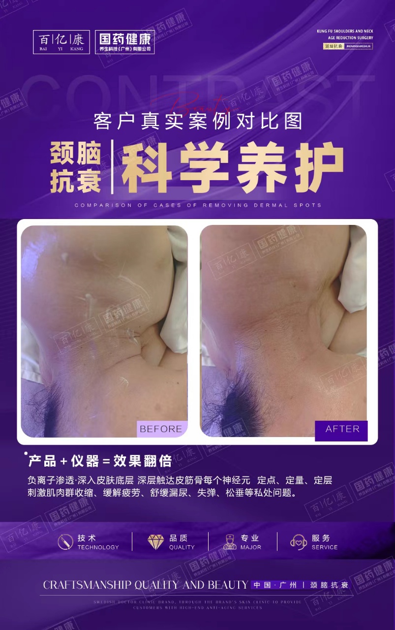 图片[41]-❤️❤️百亿康脑抗衰·体验前后效果真实案例！-百亿康