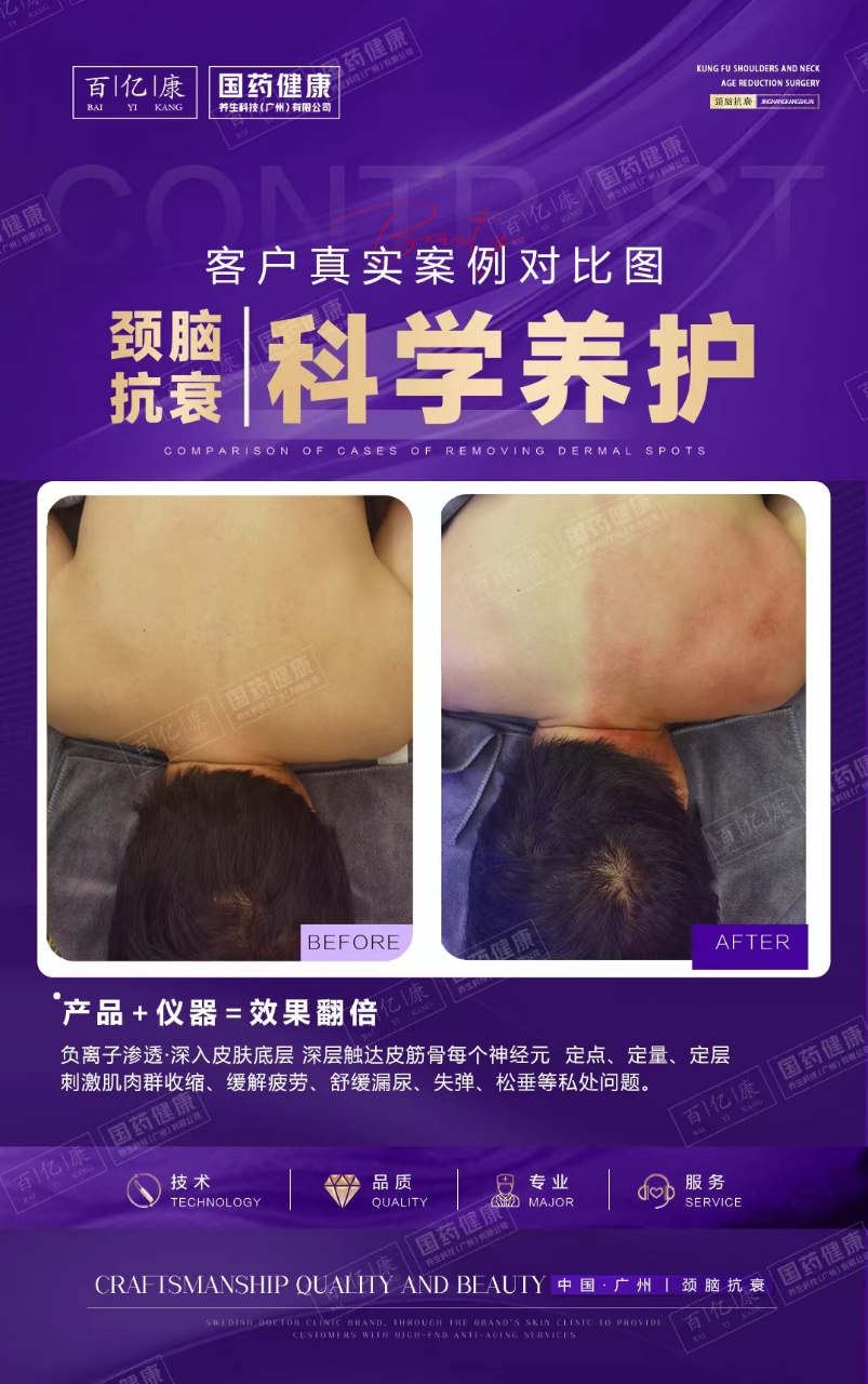 图片[34]-❤️❤️百亿康脑抗衰·体验前后效果真实案例！-百亿康