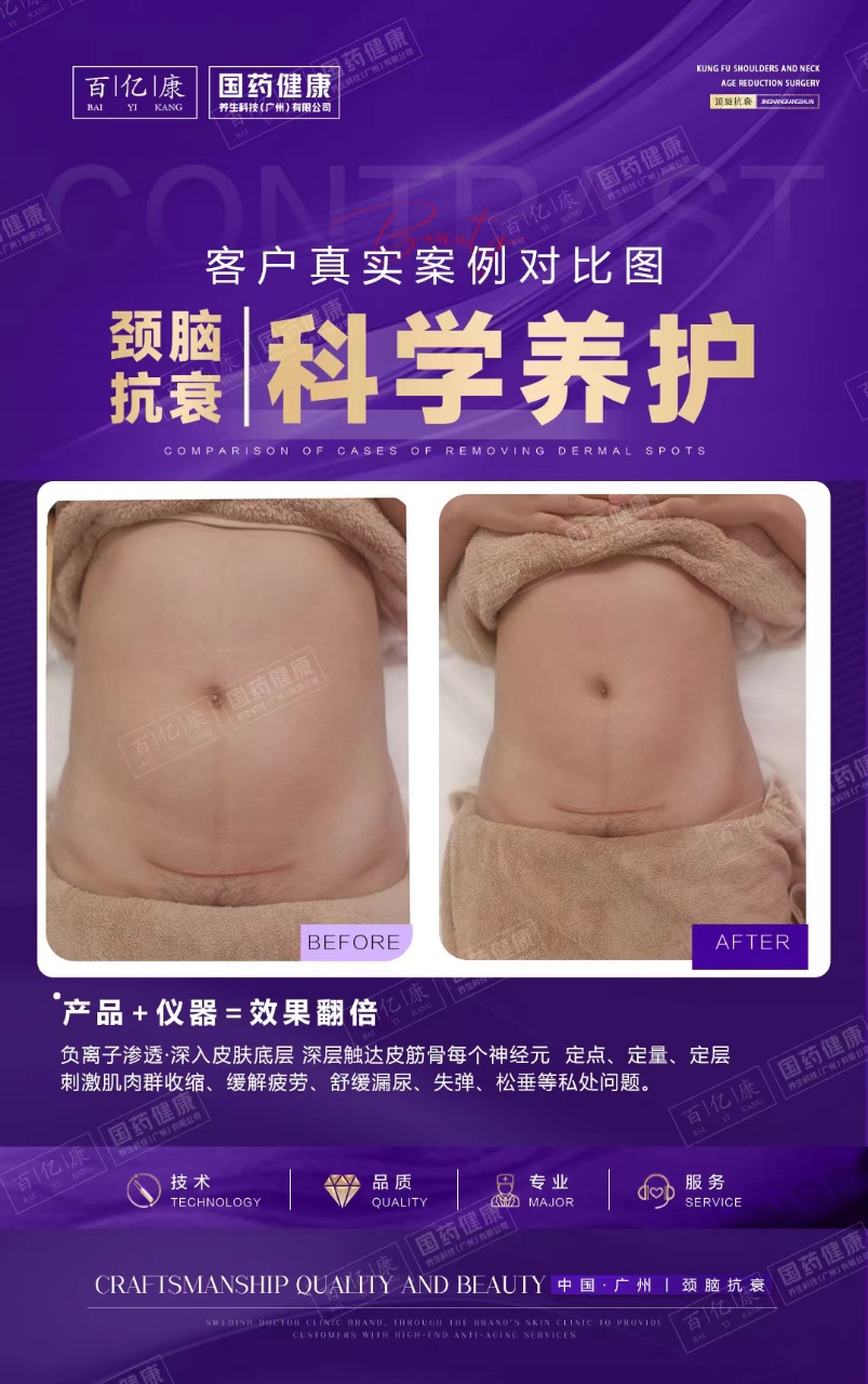 图片[42]-❤️❤️百亿康脑抗衰·体验前后效果真实案例！-百亿康