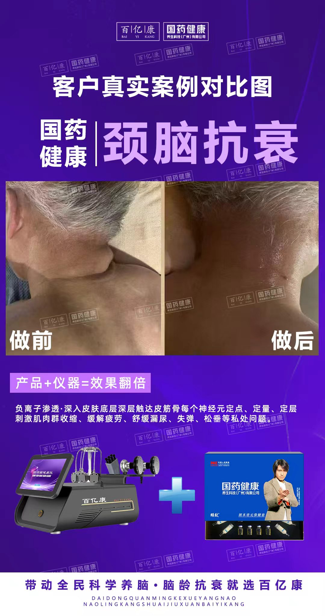 【见证案例】颈脑抗衰真实案例大公开！-百亿康